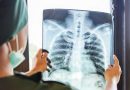 Vysoký tlak v plicích mohou mít i děti, varují lékaři